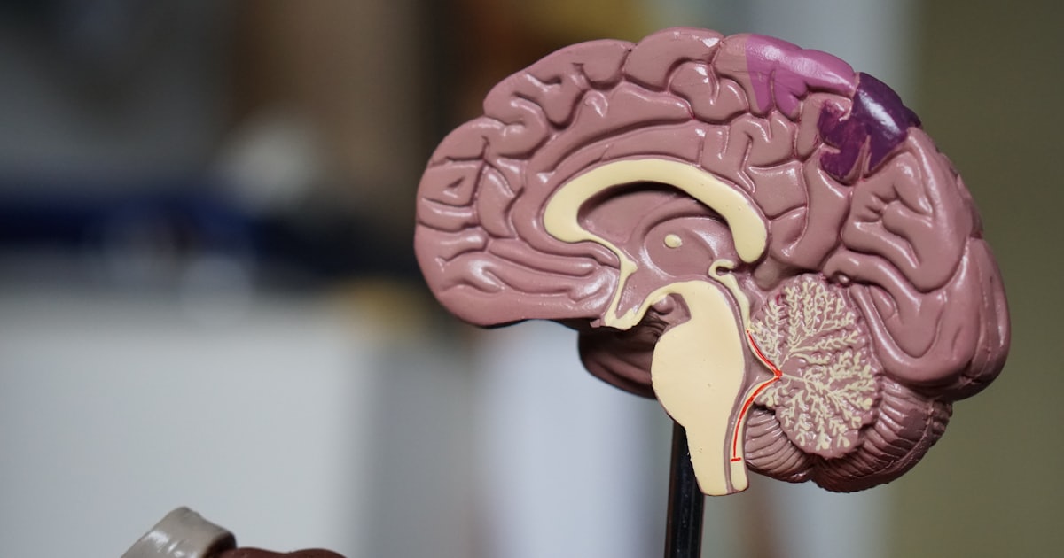 Asignatura: Neuroimagen