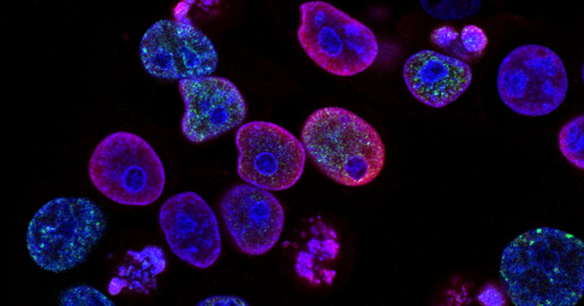 Grado de Biotecnología: descubre cómo es